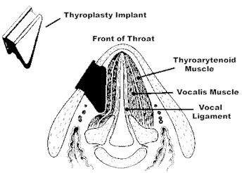 Thyro2.gif (10019 bytes)